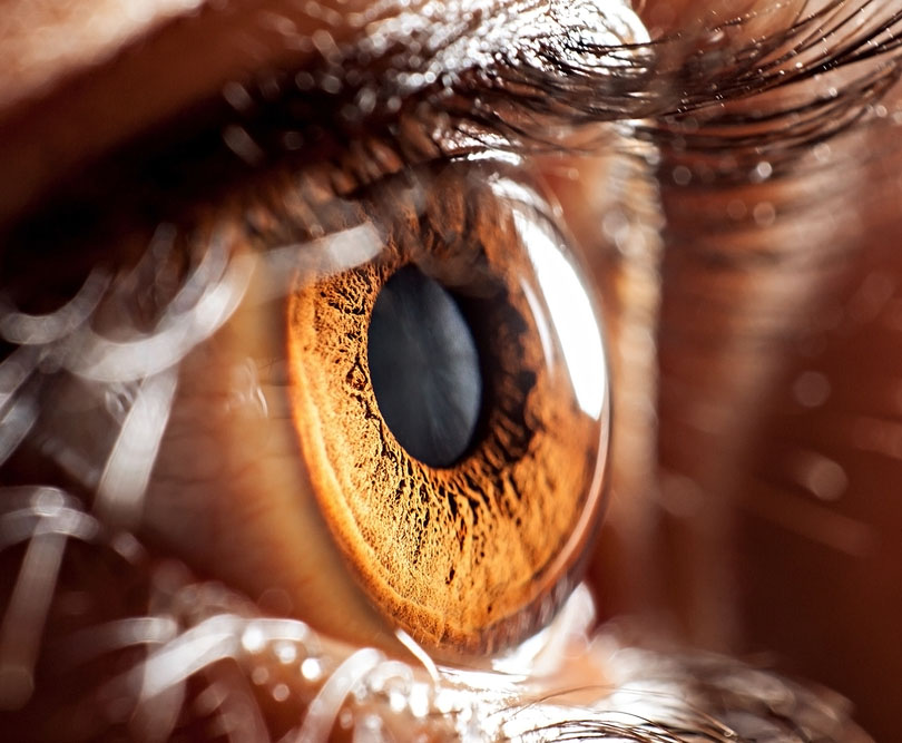 Glaucoma pode afetar 80 milhões de pessoas até 2020 