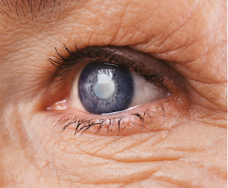 Terapia com células-tronco melhora visão e permite que pacientes leiam novamente 